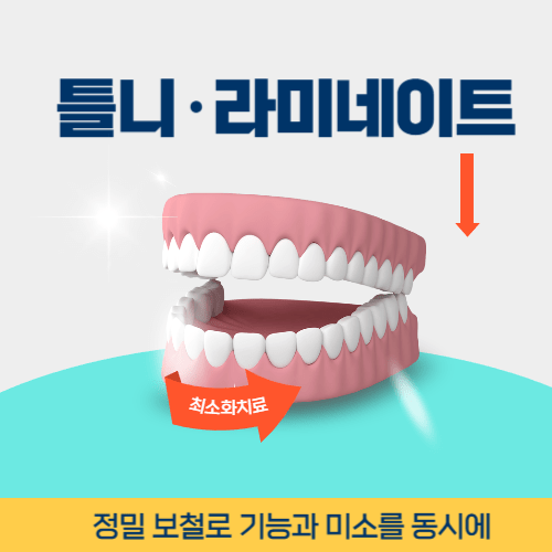 창원치과 창원시 치과 틀니 라미네이트
